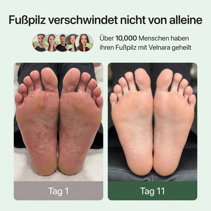 Velnara | Anti-Pilz-Seife