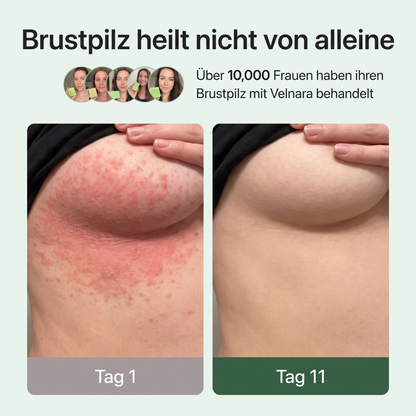 Velnara | Anti-Pilz-Seife
