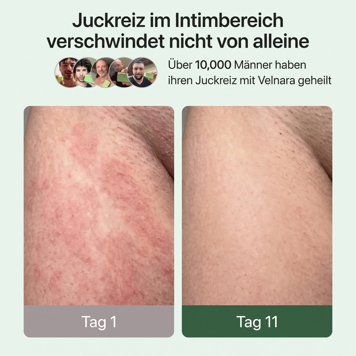 Velnara | Anti-Pilz-Seife