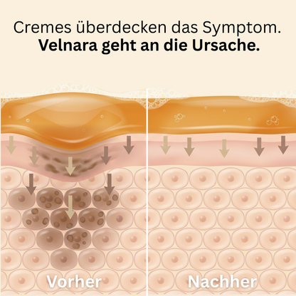 Velnara - Aufhellende Naturseife