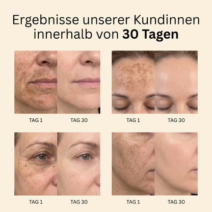 Velnara - Aufhellende Naturseife